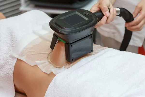 Image of person having fat freezing treatment to help weight gain Uckfield