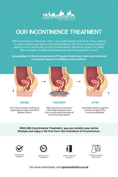 image to show how EMS treatment works for female urinary incontinence Uckfield