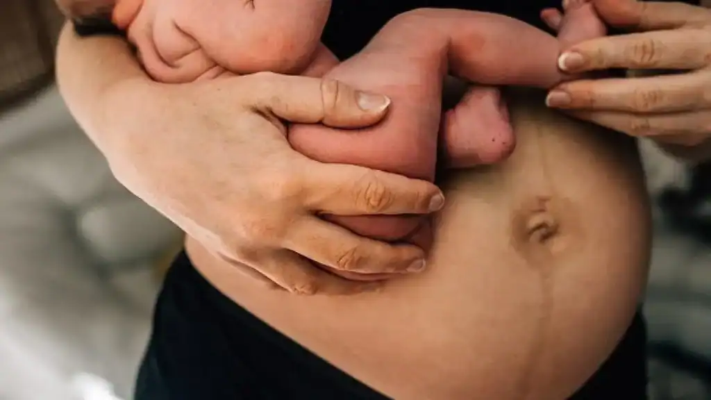 Why Is My Stomach Still Big After Pregnancy Uckfield?